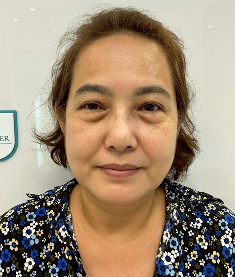 Rectangle 45 Rectangle 45