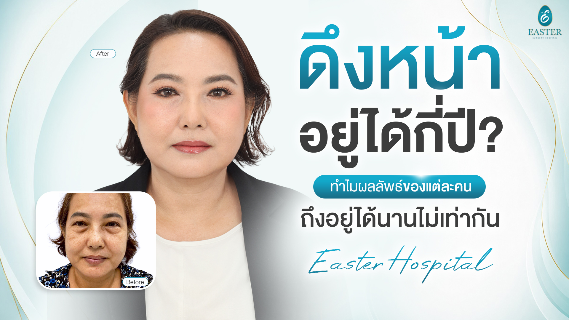 拉皮手术能维持多少年？影响拉皮效果的 key 因素｜Easter Hospital